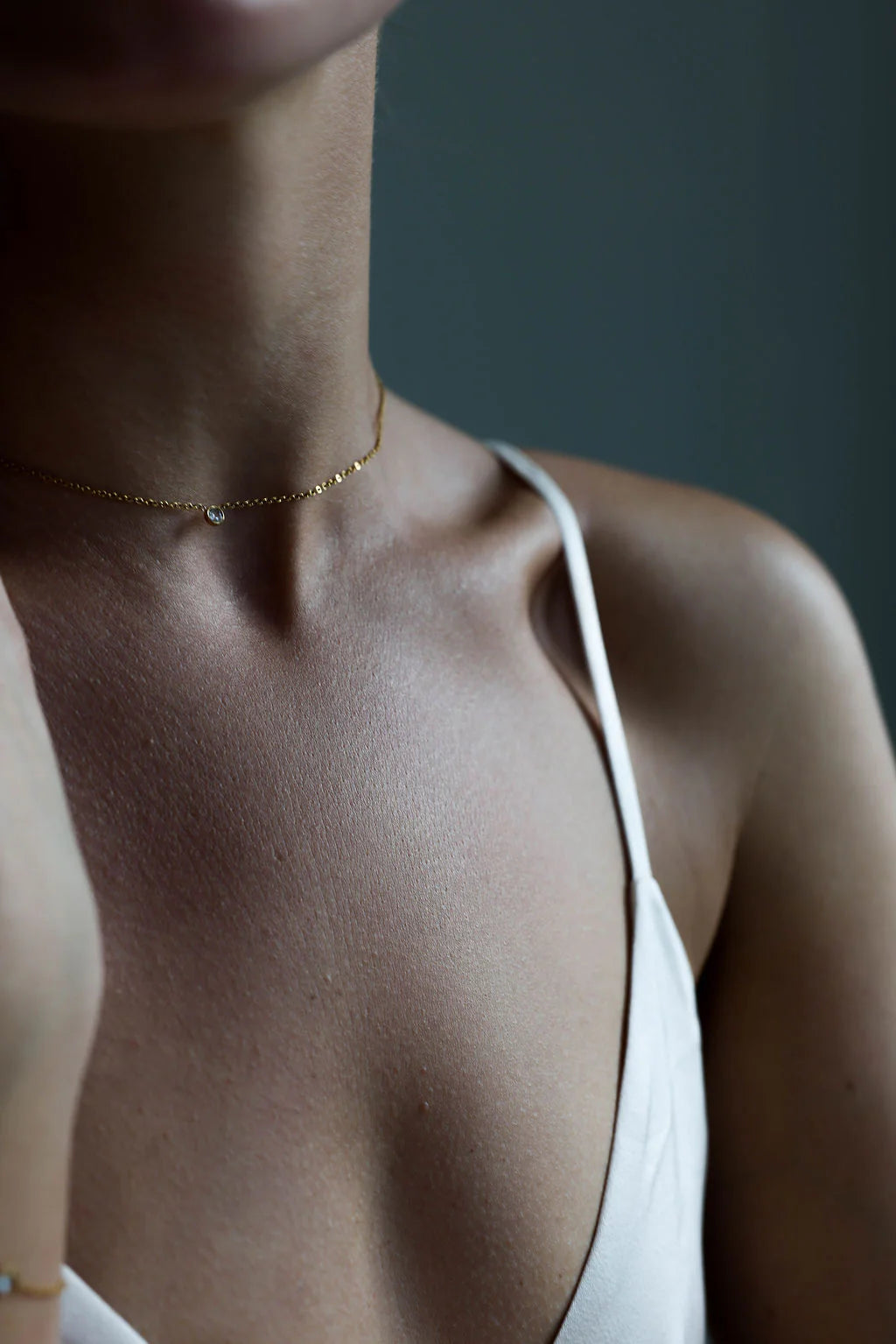 CHARLOTTE Ketting GP